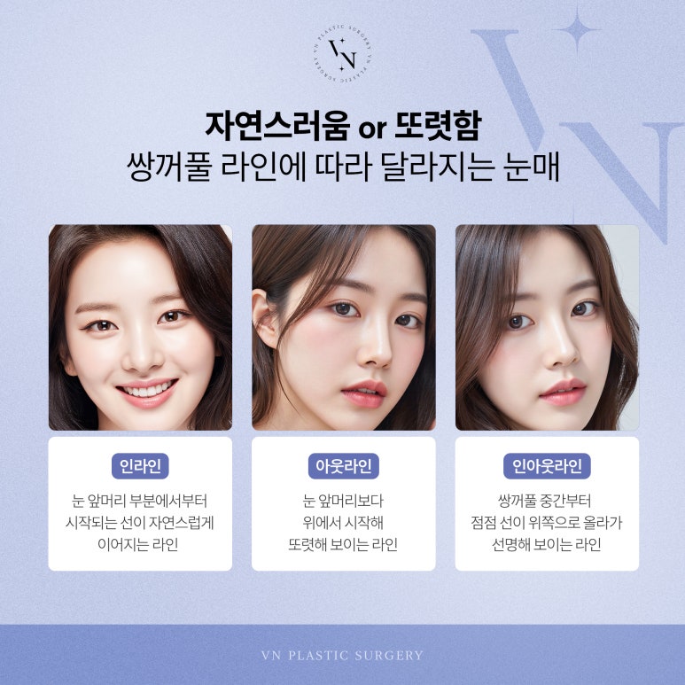 What Kind of Eyes Suit the Trendy In-Out Double Eyelid Line? image 2