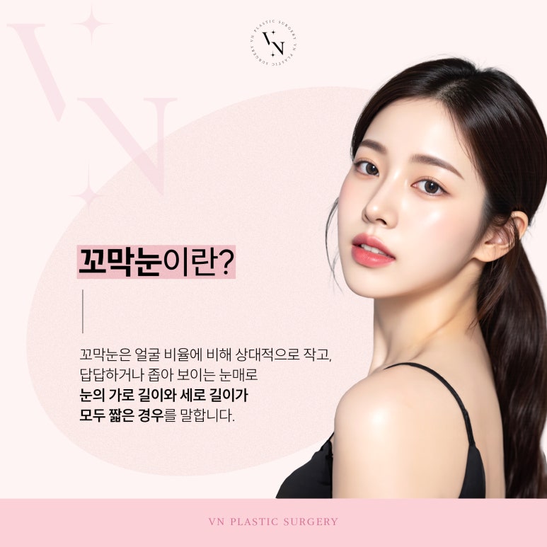 브이엔성형외과, 꼬막눈 개선하는 트임수술 관련 이미지 2