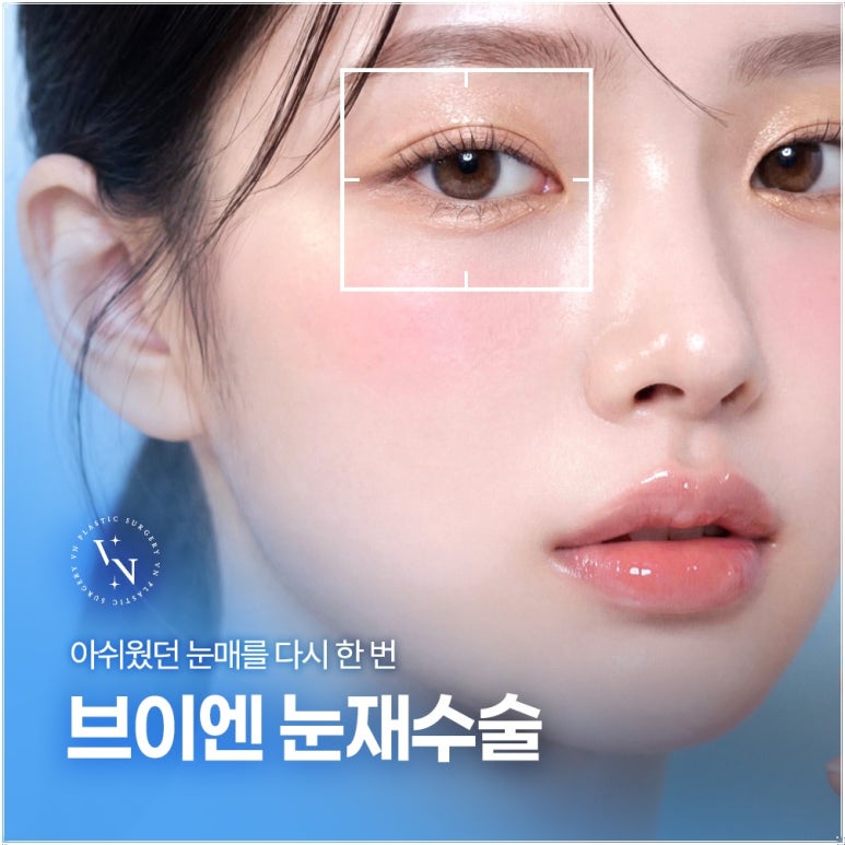 강남눈재수술, 원인이 다르면 방법도 달라집니다 관련 이미지 1
