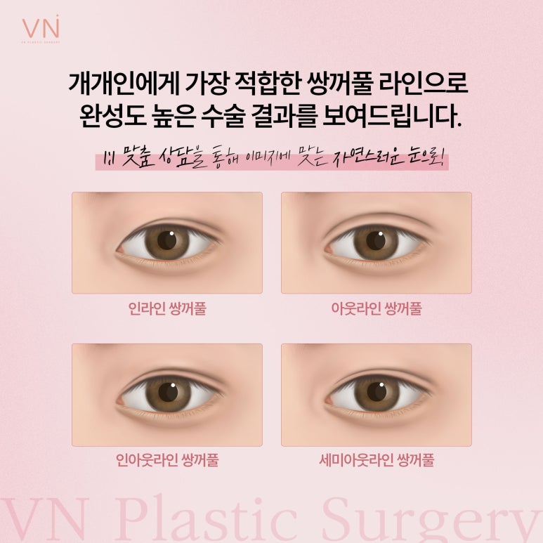 빠른회복과 자연스러움이 특징인 자연유착 쌍꺼풀수술 관련 이미지 6