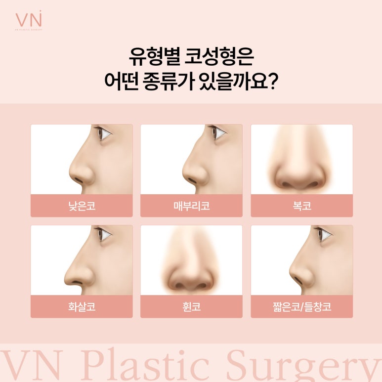 개인별 유형에 따른 코성형 수술방법 관련 이미지 2