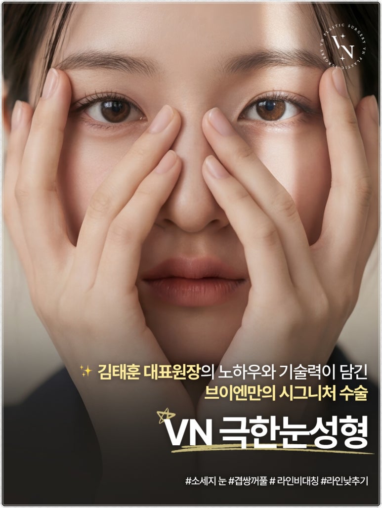 Why Extreme Eye Revision Surgery Is Difficult for Hooded Eyes, Asymmetric Eyes, and Double Fold Correction [VN Plastic Surgery, Gangnam] image 1