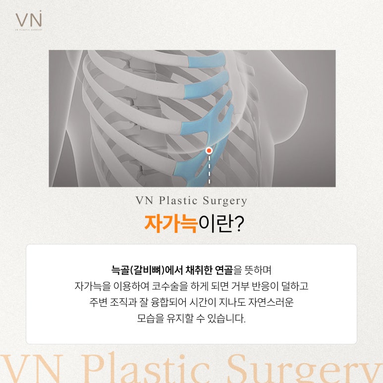 코재수술 잘하는 법! 미니자가늑 코재수술이란? 관련 이미지 2