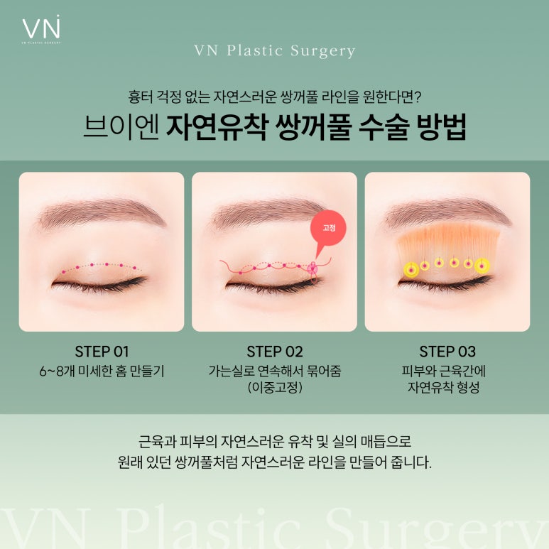Can uneven eyes be corrected with double eyelid surgery? image 3