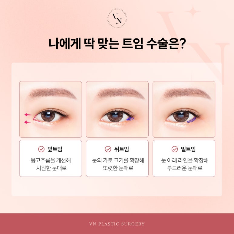 트임수술, 어떤 경우에 필요할까? 관련 이미지 2