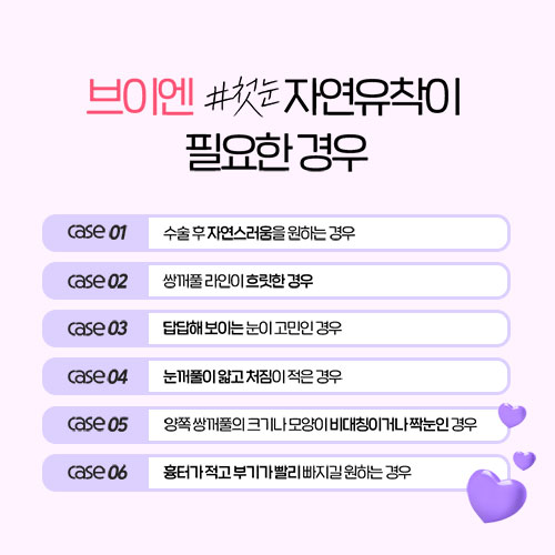 나에게 어울리는 쌍꺼풀라인 찾는 법! 쌍수 전이라면 클릭👇👇 관련 이미지 2