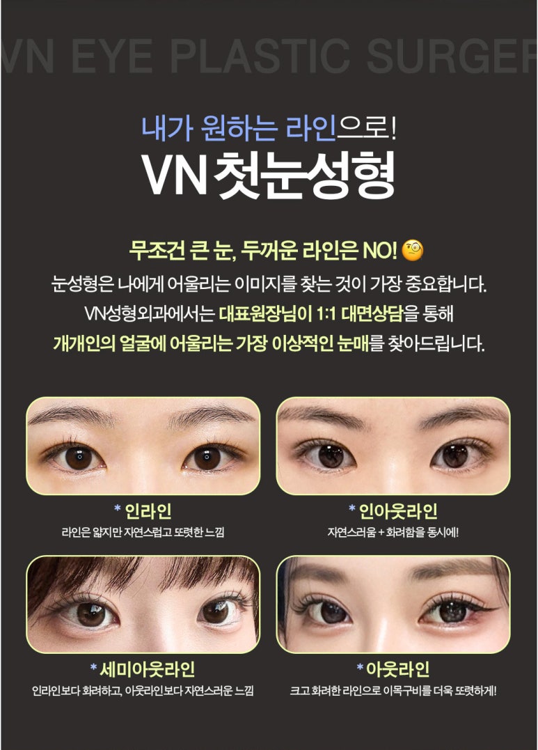 VN Plastic Surgery College Entrance Exam Eye Surgery Event πβ¨ image 4