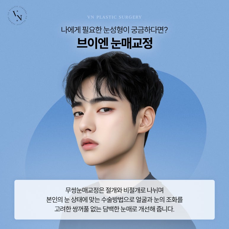 Male Double-Eyelid-Free Eye Surgery for a More Natural Eye Shape image 6