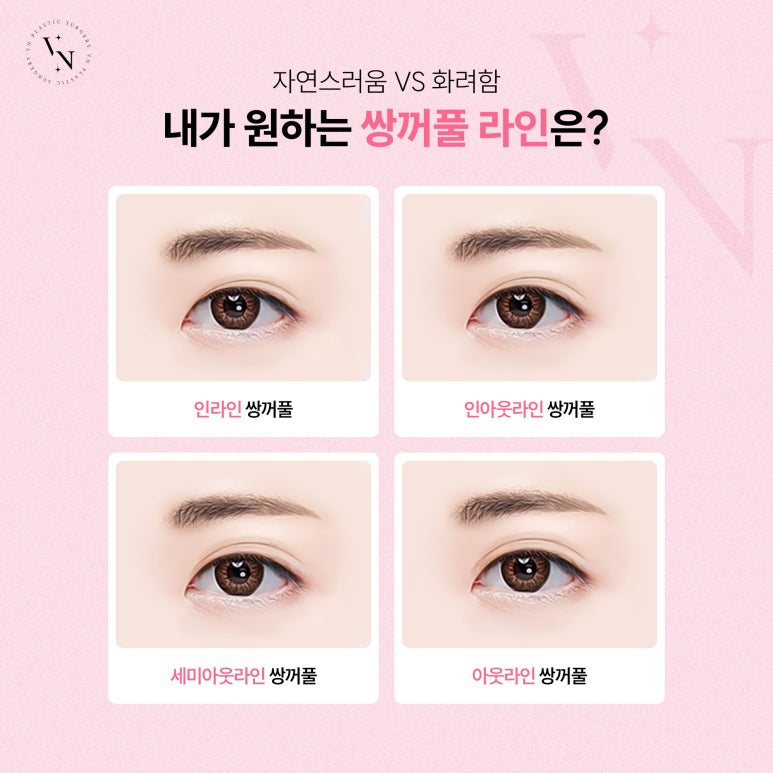 Vn Plastic Surgery: What Is the Best Way to Avoid Failure in Your First Double Eyelid Surgery? image 3