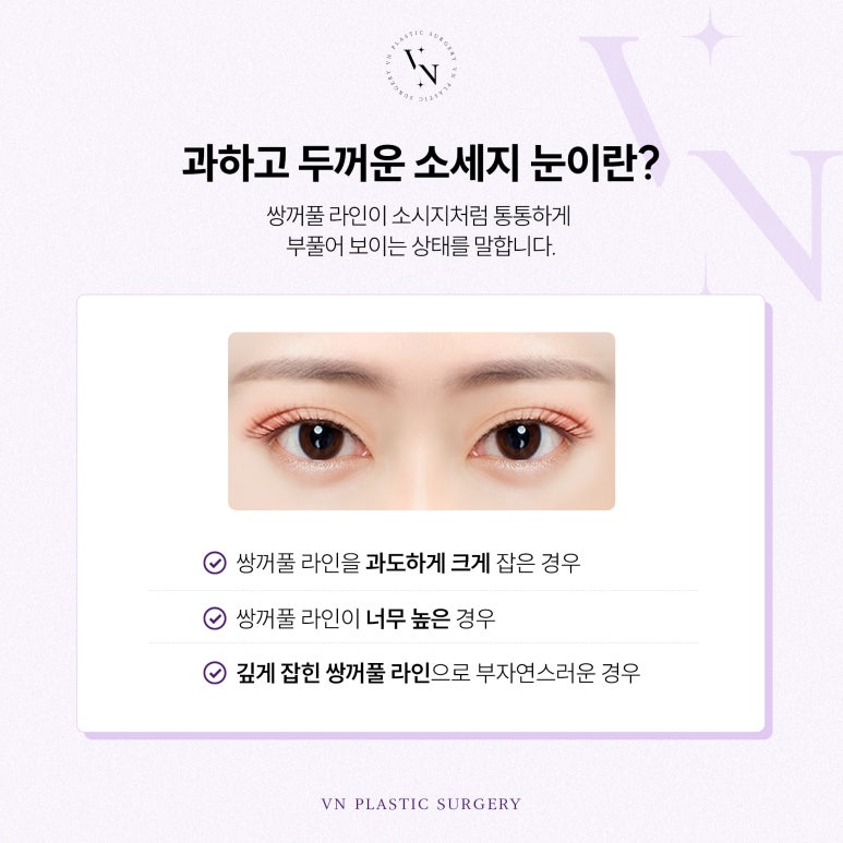 Can Sausage Eyes Be Fixed? image 2
