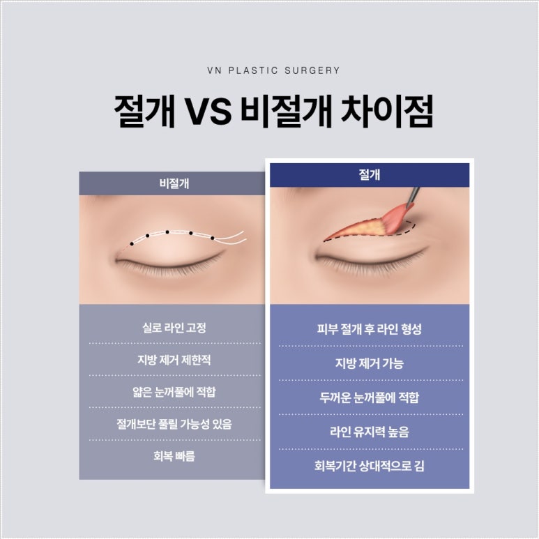 If You Need Incisional Double-Eyelid Surgery but Are Worried About Scars image 3
