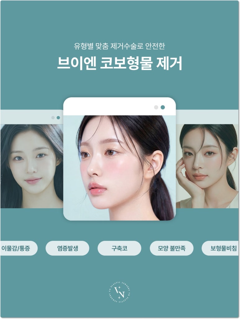 브이엔성형외과 코보형물제거 비용과 수술 후 코 모양 변화 관련 이미지 2