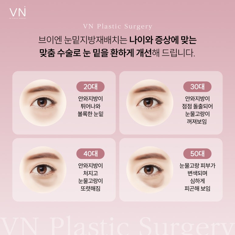 Is There a Possibility of Recurrence After Lower Eyelid Fat Repositioning Surgery? image 2