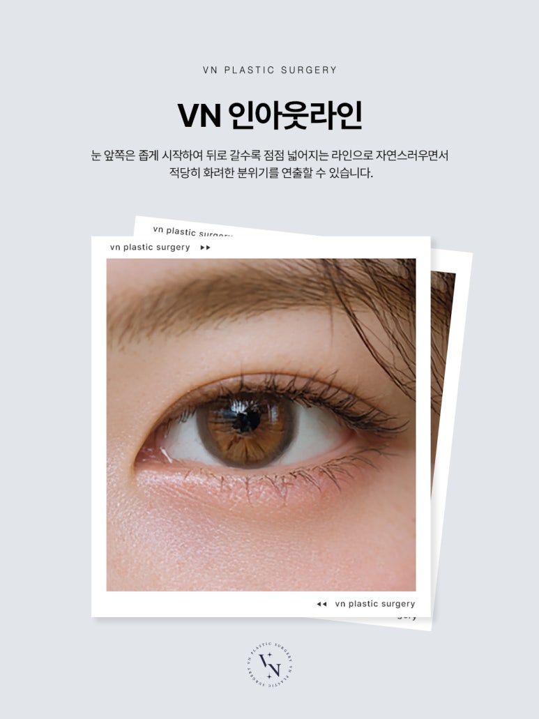 Shinnonhyeon Plastic Surgery Eye Surgery Trend: Why the In-Out Line Is Getting Attention image 2
