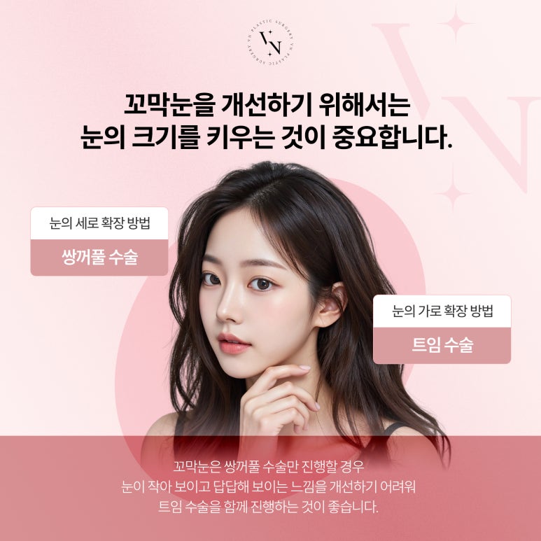 브이엔성형외과, 꼬막눈 개선하는 트임수술 관련 이미지 3