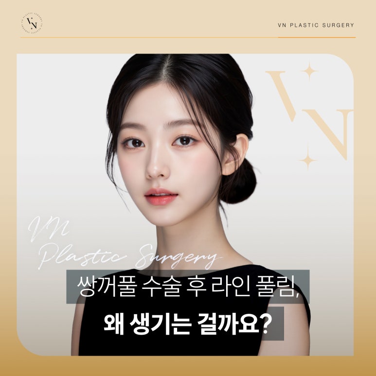 Why Does the Double Eyelid Line Loosen After Surgery, and How Can It Be Prevented? image 1