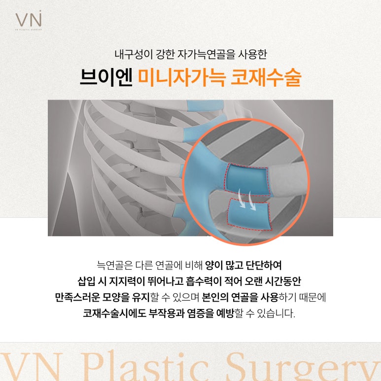 코재수술 잘하는 법! 미니자가늑 코재수술이란? 관련 이미지 3