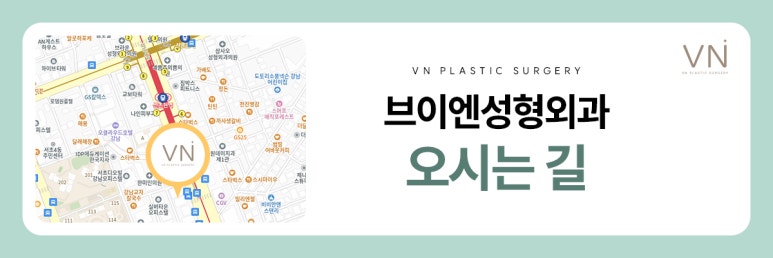 복코 수술, 일반적인 코수술과는 어떤 차이가 있을까? 관련 이미지 8