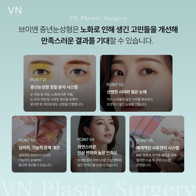 중년눈 성형 고민하고 있다면? 관련 이미지 6