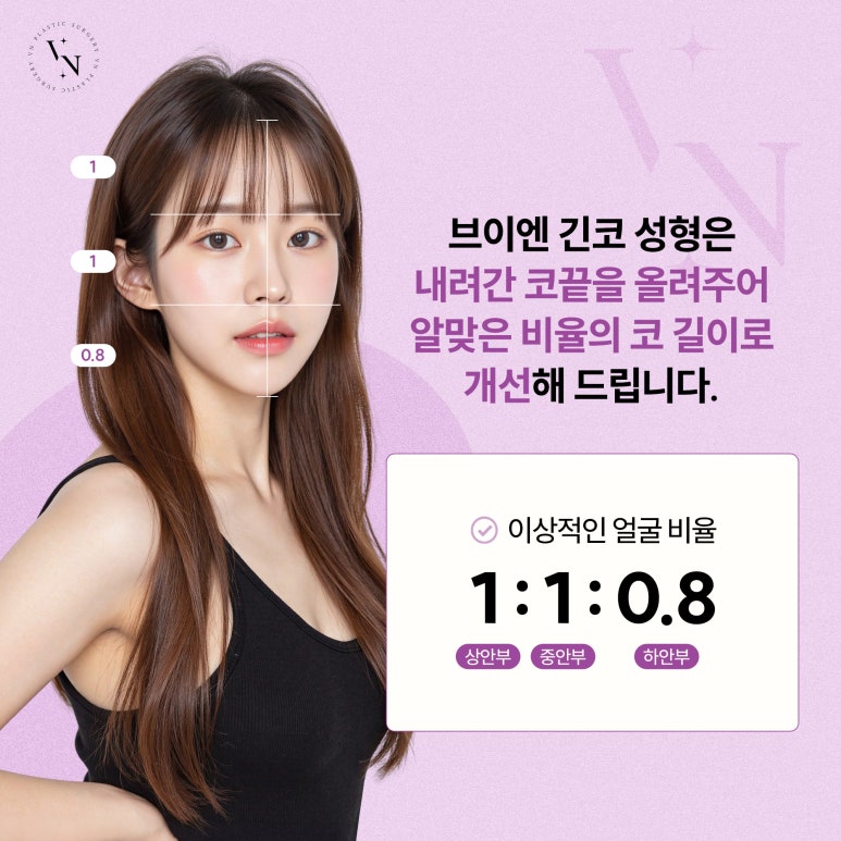 VN Plastic Surgery, Worried About a Long Midface? image 3