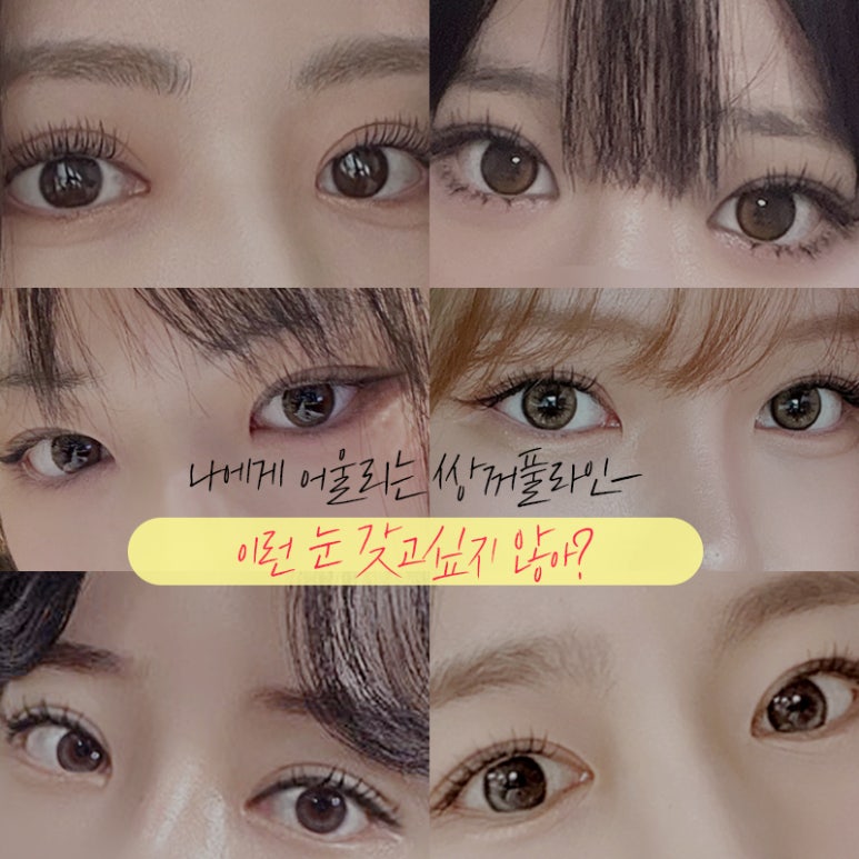 인라인? 아웃라인? 쌍꺼풀수술라인 종류 알아보기 (+연예인 쌍꺼풀) 관련 이미지 2
