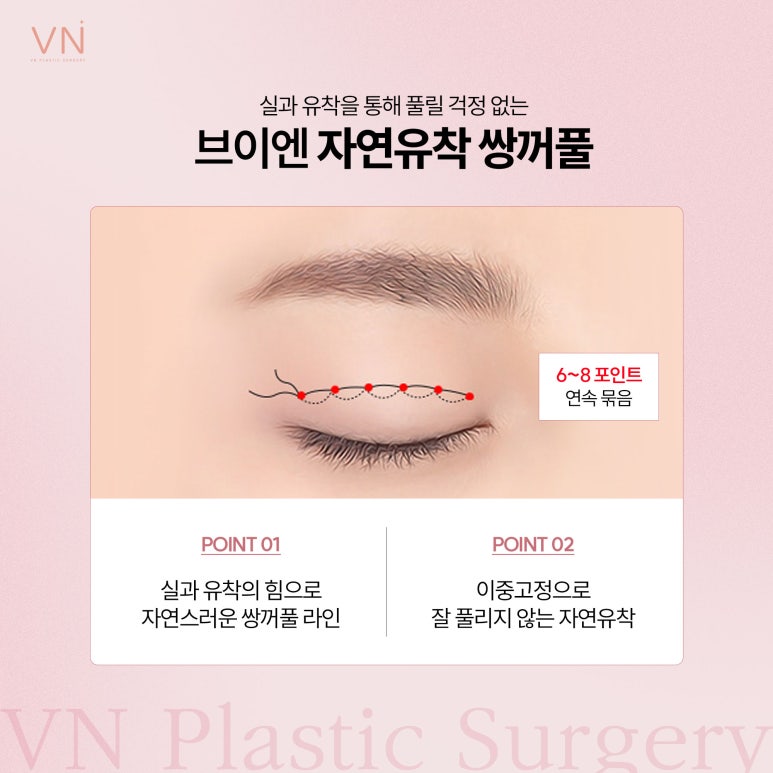 빠른회복과 자연스러움이 특징인 자연유착 쌍꺼풀수술 관련 이미지 2