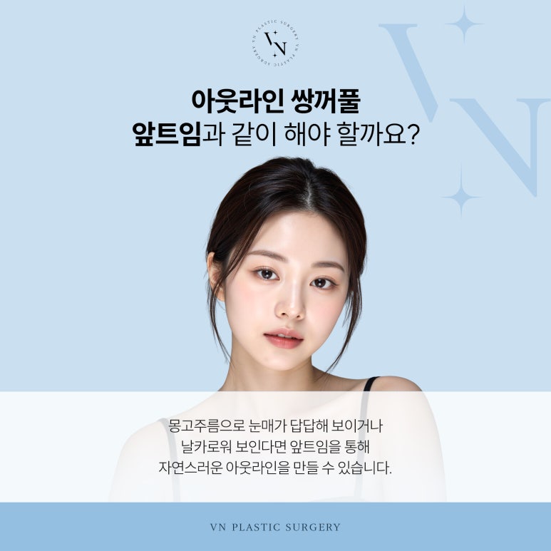 Do I Need to Get an Out-Outline Double Eyelid and Epicanthoplasty Together? image 4