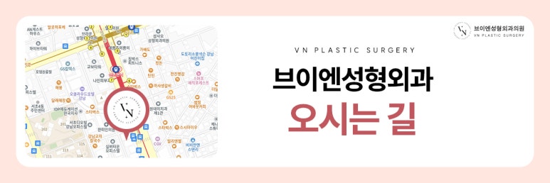 트임수술, 어떤 경우에 필요할까? 관련 이미지 9