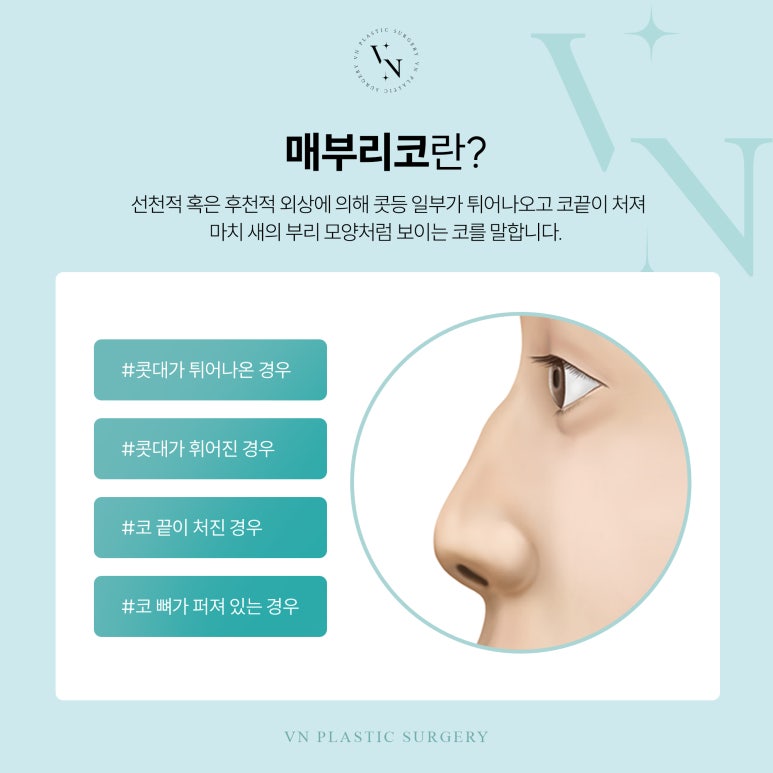 Is it possible to correct a hooked nose without silicone? image 2