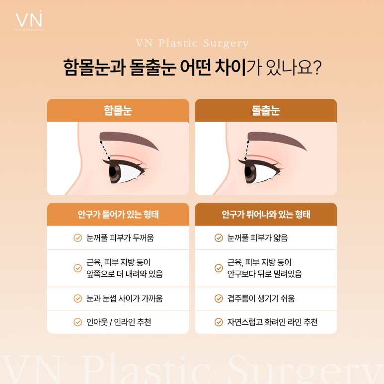 함몰눈과 돌출눈 중에 어떤 눈이 수술 결과가 좋을까? 관련 이미지 2