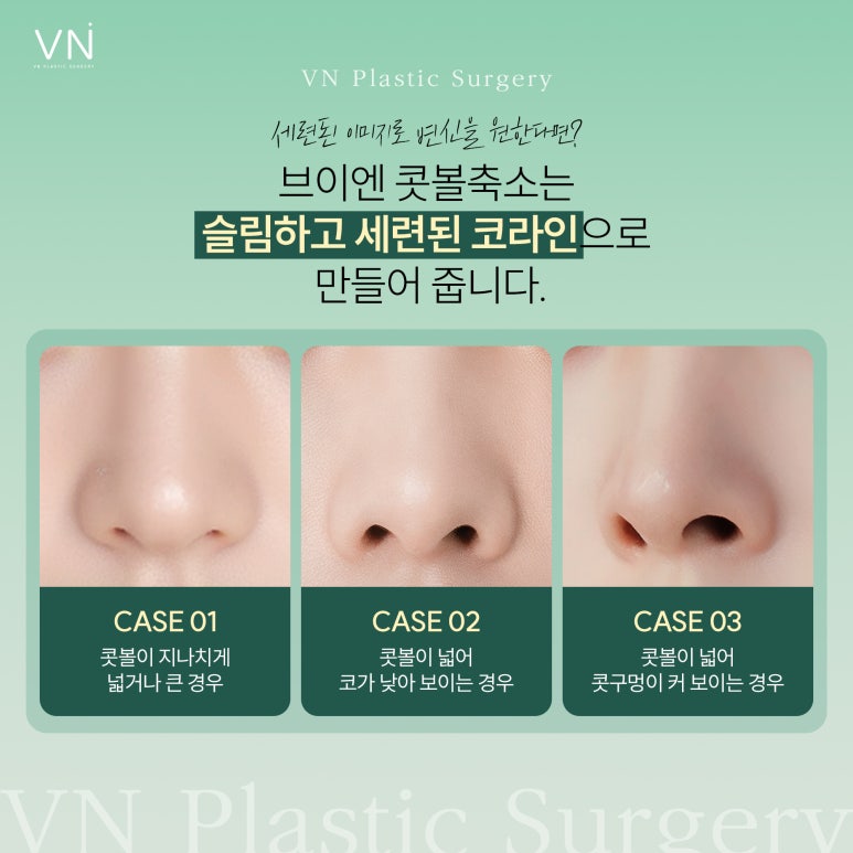Let’s Learn About Who Is a Candidate for Alar Reduction Surgery and the Surgical Methods! image 2