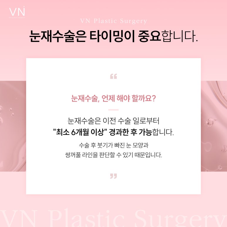 눈재수술이 가장 적당한 시기는 언제일까? 관련 이미지 2