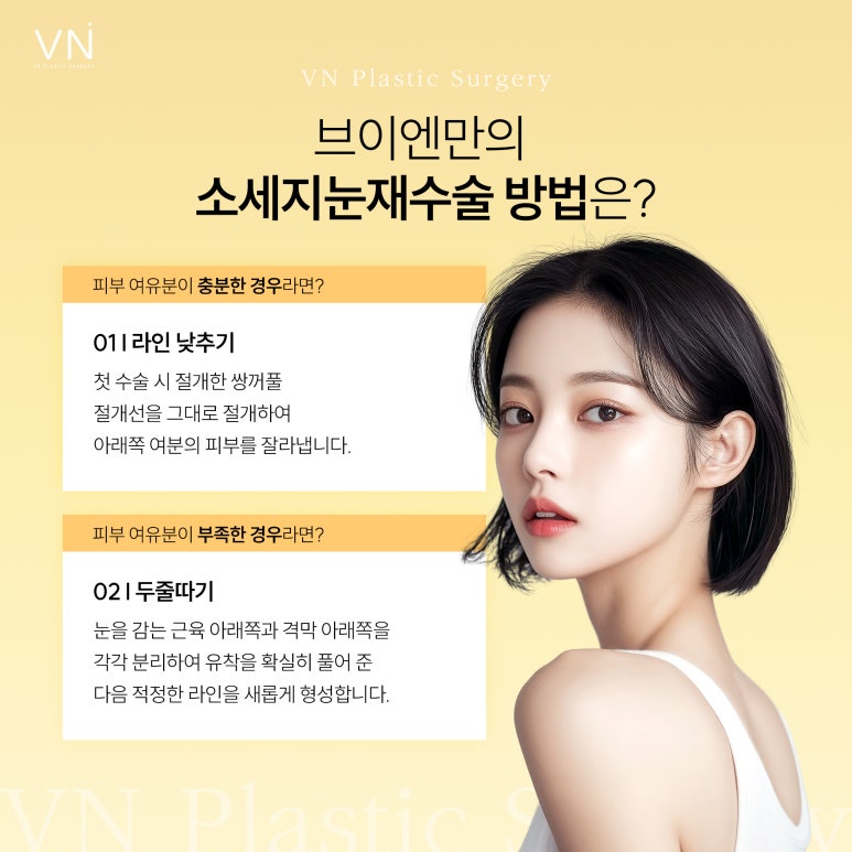 눈성형 실패 후 소세지 눈, 두꺼운 쌍꺼풀로 스트레스 받는다면? 관련 이미지 4