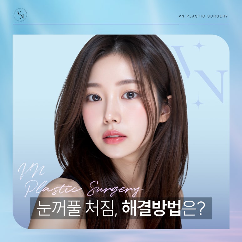 VN Plastic Surgery: What Is the Solution for Drooping Eyelids? image 1