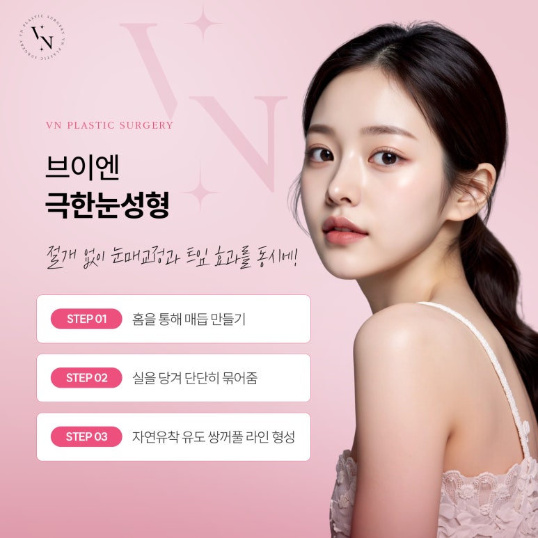 앞트임 없이도 또렷해 보이는 눈매를 원한다면? 관련 이미지 4
