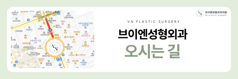 브이엔성형외과, 쌍꺼풀 수술과 눈매교정 차이점은? 관련 이미지 8