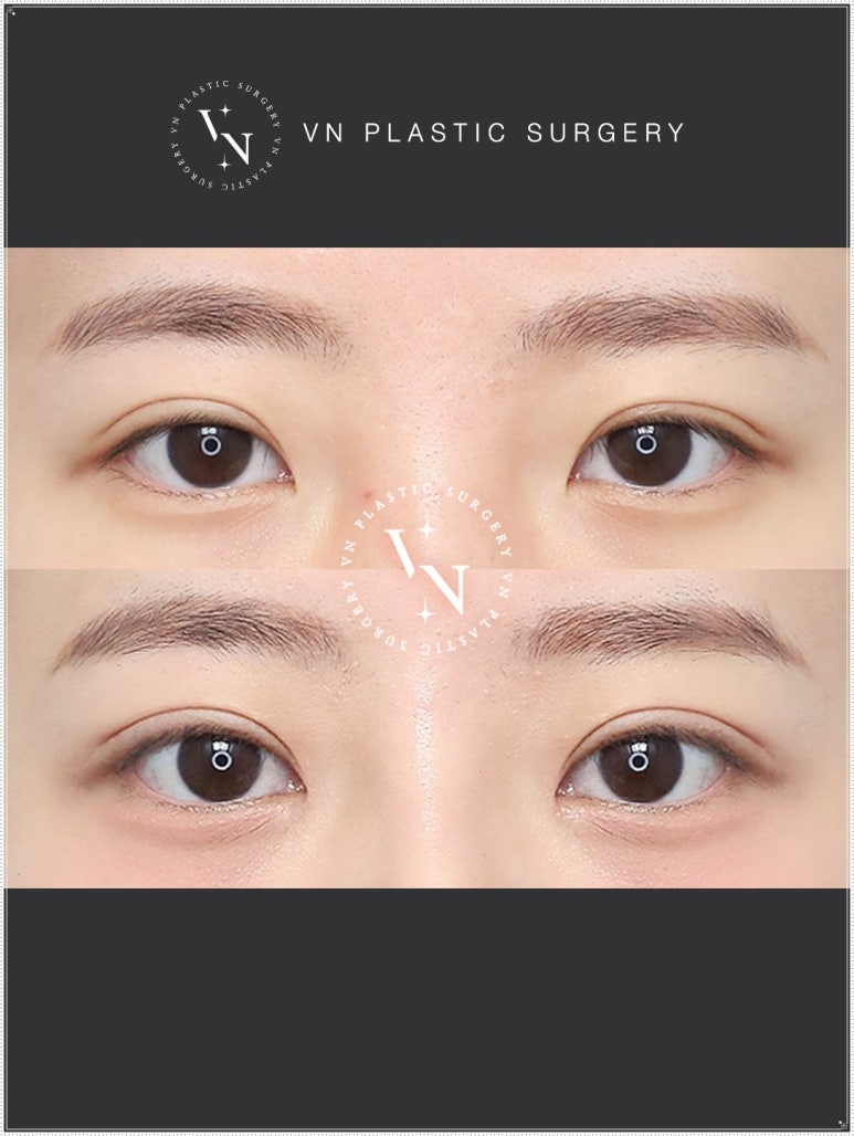 Turn Your Complexes into Confidence: How to Apply for the VN Plastic Surgery Real Model Program image 5