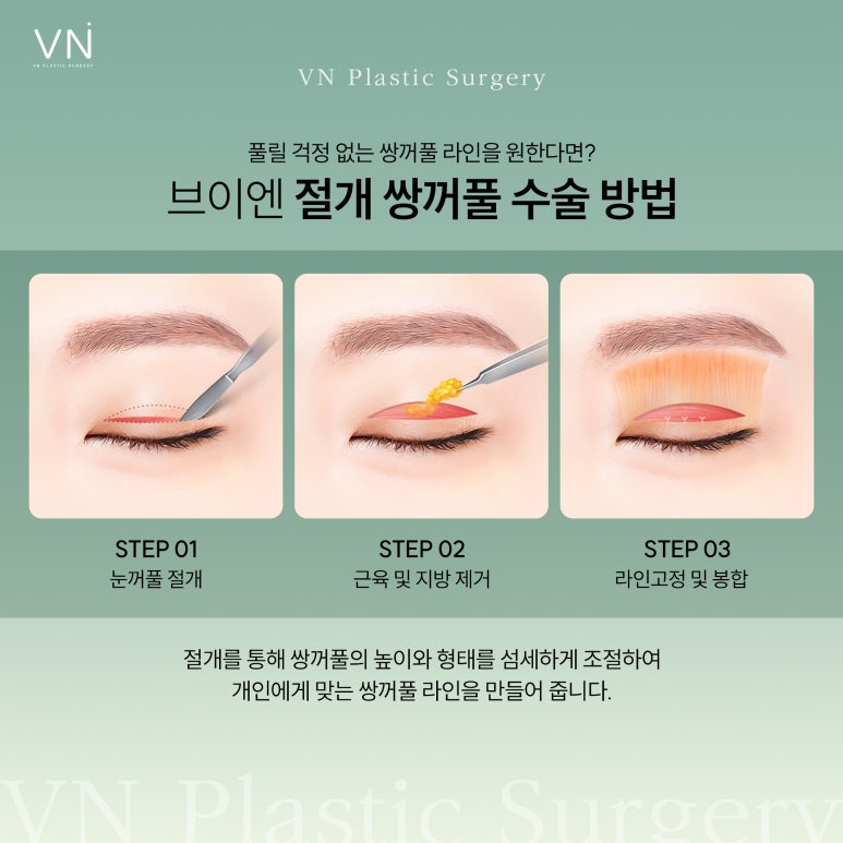 Can uneven eyes be corrected with double eyelid surgery? image 4
