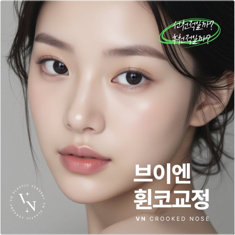 [VN Plastic Surgery] The Key to Correcting a Crooked Nose Is Identifying the Cause: Congenital or Acquired? image 1