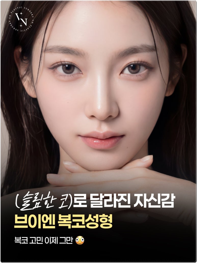 Why the Tip of the Nose Looks Blunt and Large: VN Plastic Surgery’s Bulbous Nose Surgery image 1