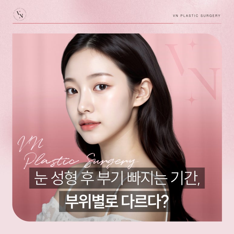 눈 성형 후 부기 빠지는 기간, 부위별로 다르다? 관련 이미지 1