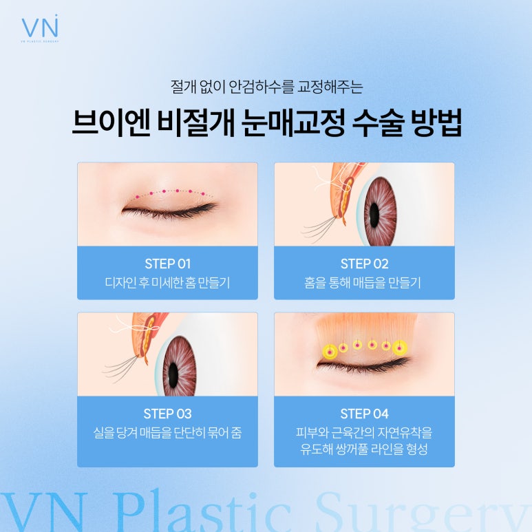 Eyelid Correction? The Difference Between Incisional and Non-Incisional Methods! image 4