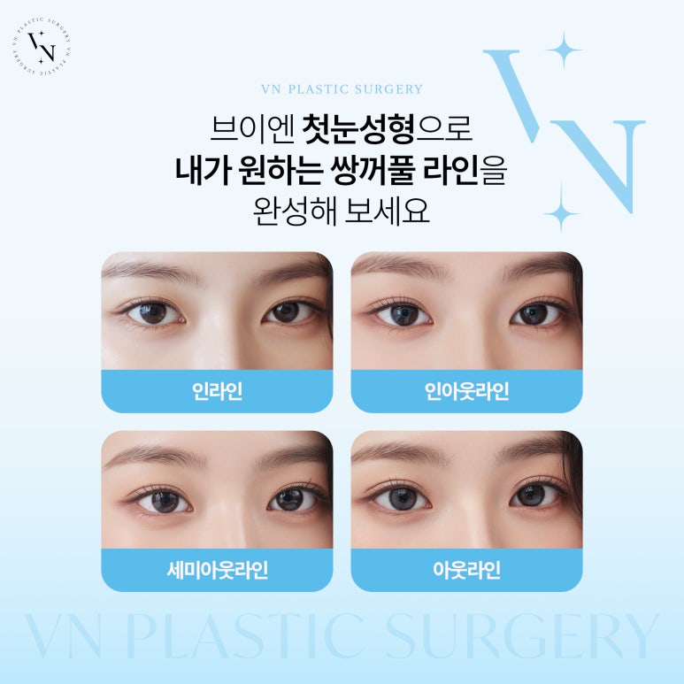 [VN Plastic Surgery] It’s My First Eye Surgery—Will There Be a Lot of Scarring? image 4