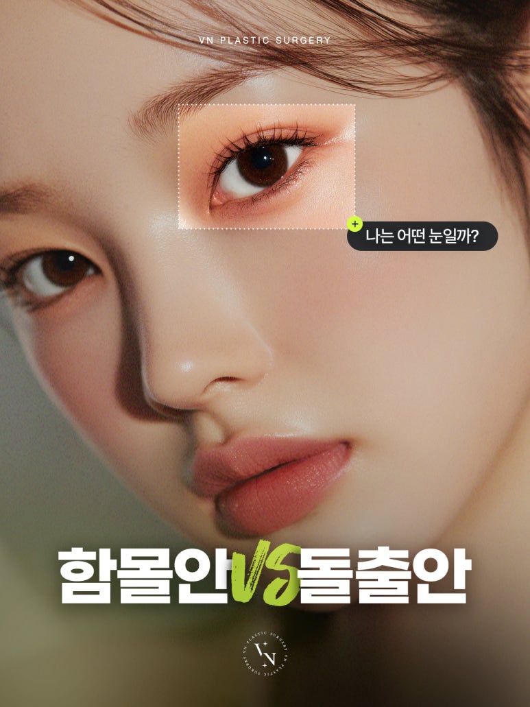 [Sinnonhyeon Plastic Surgery] Before Your First Double Eyelid Surgery, Be Sure to Check This! Do I Have Sunken Eyes or Protruding Eyes? image 1