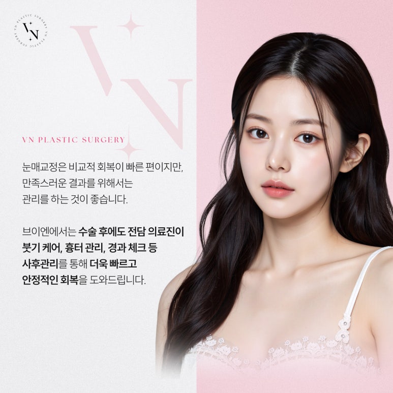 앞트임 없이도 또렷해 보이는 눈매를 원한다면? 관련 이미지 6