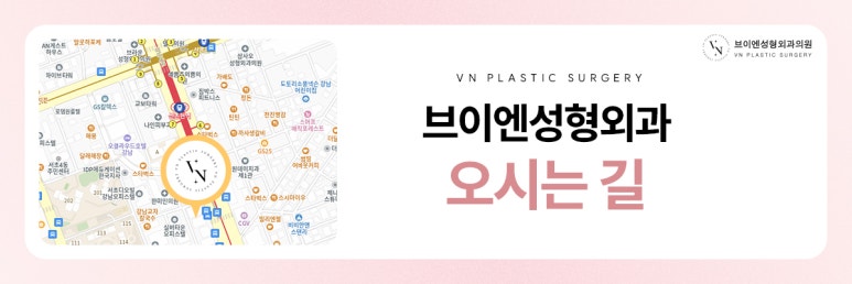 브이엔성형외과, 꼬막눈 개선하는 트임수술 관련 이미지 8