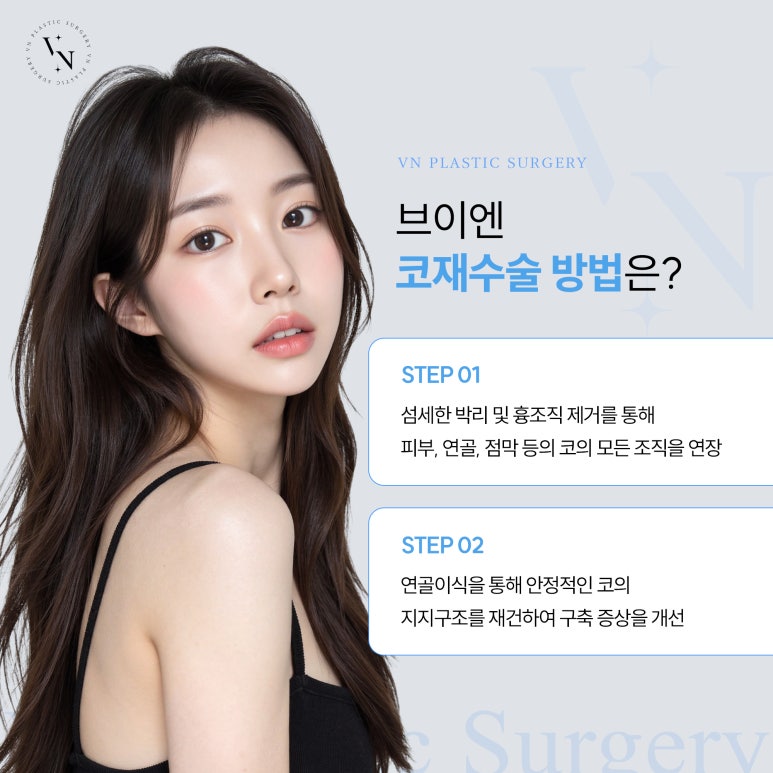 뾰족코 개선을 위한 코재수술 관련 이미지 5