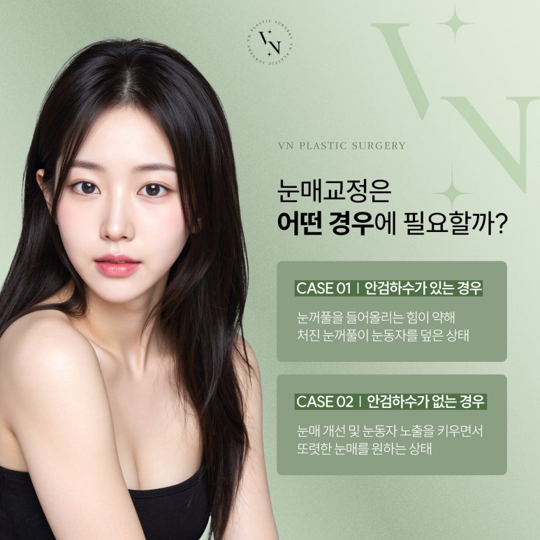 브이엔성형외과, 쌍꺼풀 수술과 눈매교정 차이점은? 관련 이미지 5