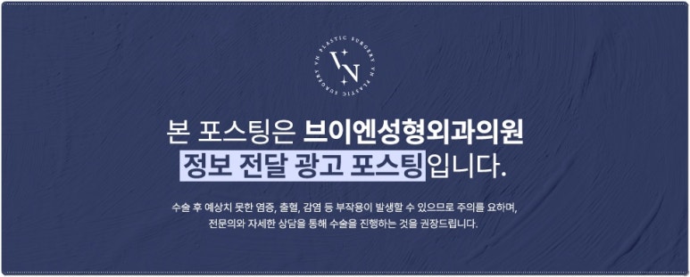 [VN Plastic Surgery] The Key to Correcting a Crooked Nose Is Identifying the Cause: Congenital or Acquired? image 15