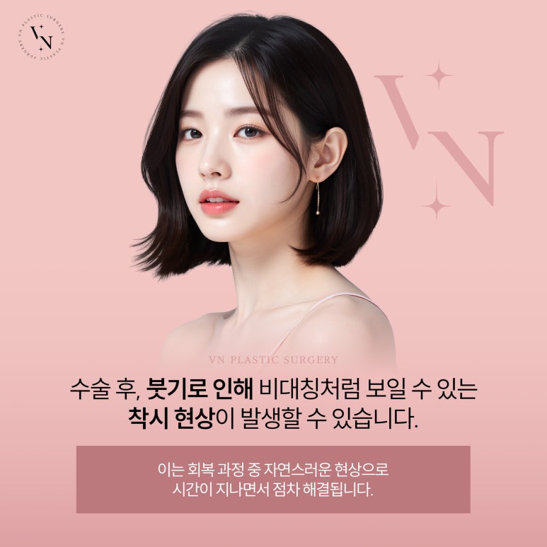 콧구멍 비대칭, 코 성형으로 교정 가능할까? 관련 이미지 6
